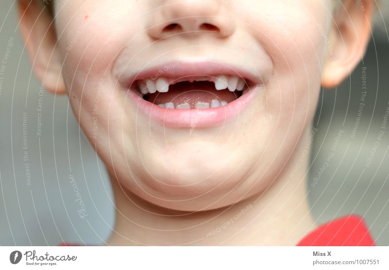 Courage to fill a gap Human being Masculine Child Toddler Boy (child) Infancy Mouth Teeth 1 3 - 8 years Tooth space Gap Dentist Dental care Toothache Growth