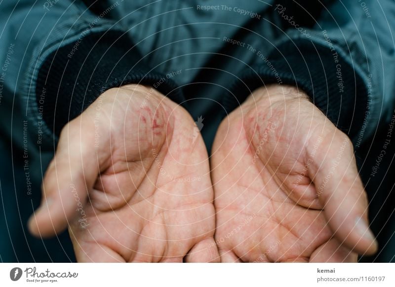 FR UT | From falling and getting up Human being Skin Hand Fingers Ball of the hand Palm of the hand 1 Jacket Gray Black Adversity Pain Indicate Wound