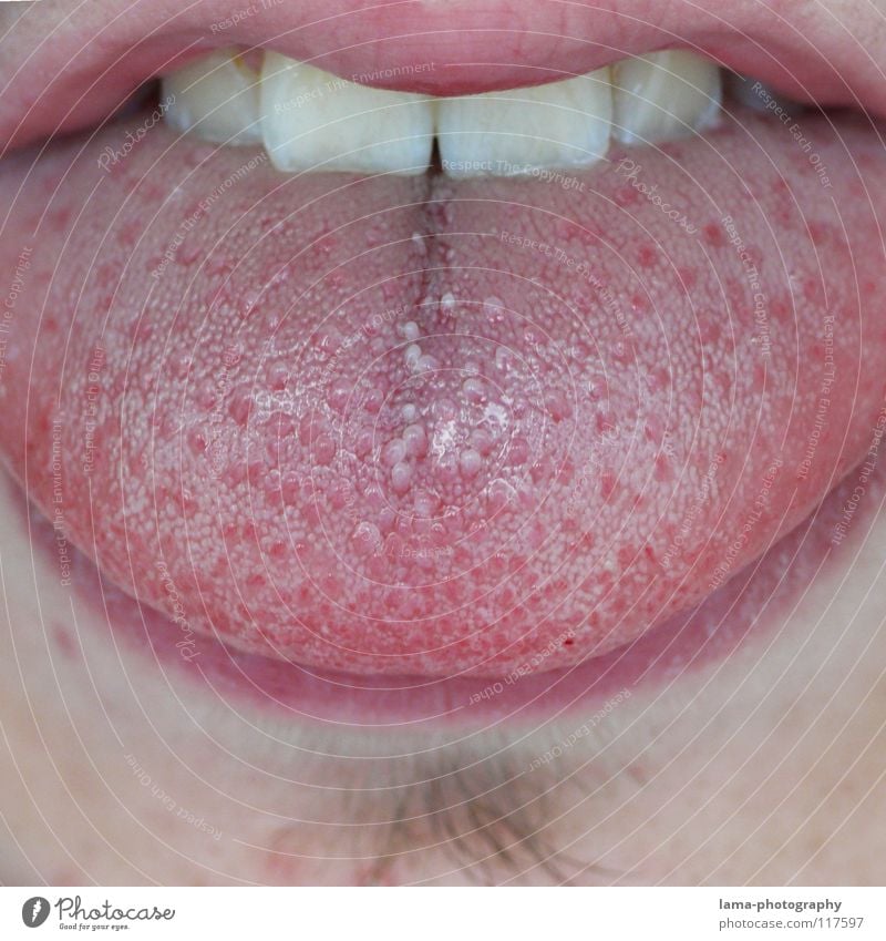 doctoral games Lips Pink Red Facial hair Sense of taste Nutrition Senses Mucous membrane Dry Damp Wet Mucus To talk Bacterium Dentist Investigate