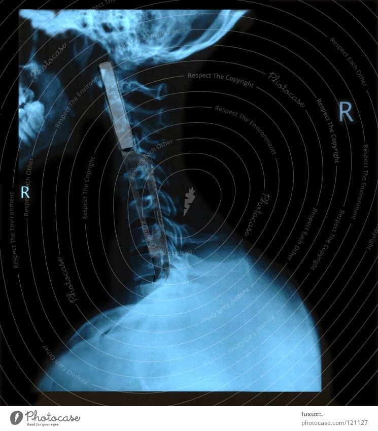 FREAK Healthy Illness Accident Drinking Skeleton Patient Health care Lung Doctor Surgeon Diagnosis Transparent Anatomy Spinal column Operation X-ray photograph