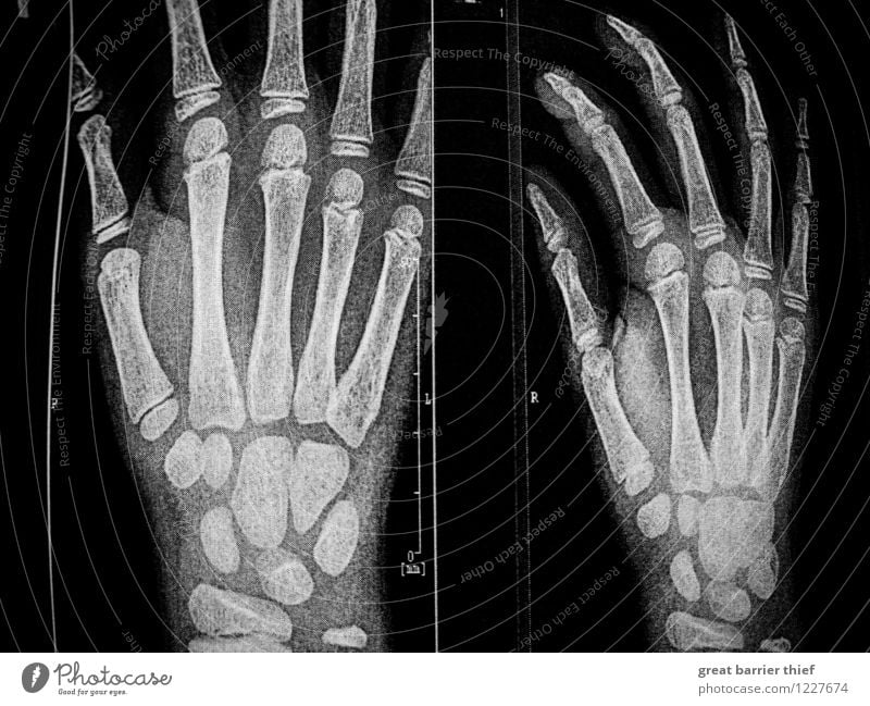 Skeleton hands X-ray image Human being Masculine Boy (child) Hand Fingers 3 - 8 years Child Infancy Authentic Creepy Black White X-ray photograph