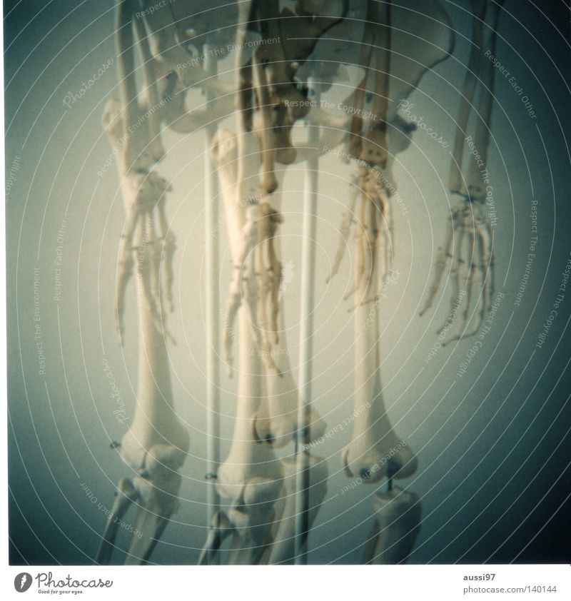 Holga? No, grazie! Double exposure Italy Skeleton Ossi Knee cap Radius Sacrum Doctor Anatomy Thigh Lower leg Spokes Fingers Hand Analog Medium format Lomography