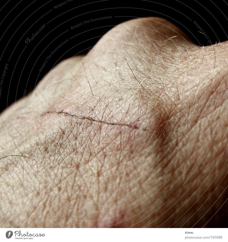 Lifelines #08 Skin Hand Round Scar knuckles Crust Healing Vessel Scrape Scratch mark Hair Pore Isolated Image Dark background Partially visible Detail