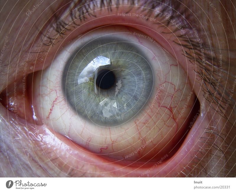 blood eye Conjunctivitis Vessel Red Man Eyes Iris Opthalmology