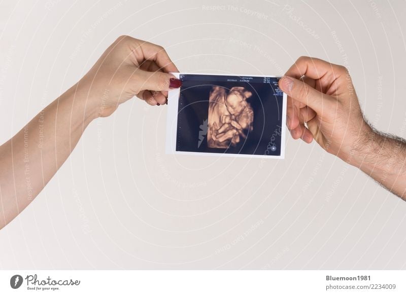Parent holding unborn baby Sonography image in hands Medication Life Parenting Science & Research Child Technology Human being Baby Woman Adults Man Parents
