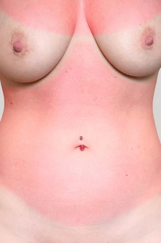 sunburn Lifestyle Body Sunbathing Swimming & Bathing Feminine Woman Adults Skin Breasts Stomach 1 Human being 30 - 45 years Piercing Frustration Threat