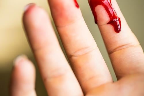 Finger cut, bleeding injured with knife Body Skin Health care Medication Hospital Human being Woman Adults Hand Fingers Drop Red White Pain Horror Cut Blood