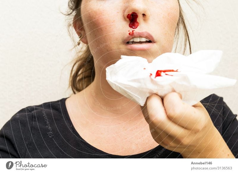 Wound nosebleed, woman bleeding from her nose Body Skin Face Health care Illness Medication Relaxation Human being Woman Adults Mouth Drop Small Red White Pain