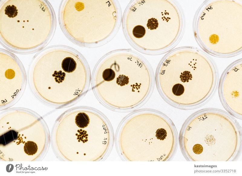 Growing Bacteria in Petri Dishes. Plate Health care Medication Science & Research Laboratory Technology Culture Cleaning Growth Effort agar agar plate