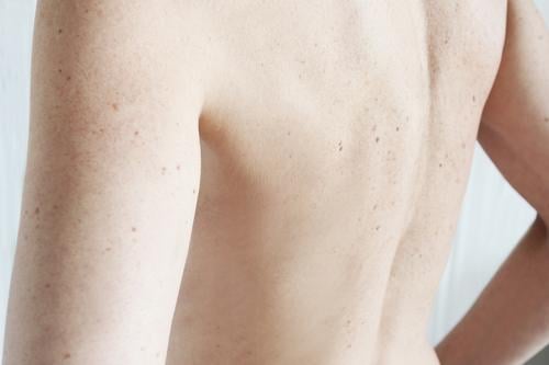 back Back Skin Woman Freckles Mole liver spots Shoulder sleeves Feminine Naked Adults Body Interior shot 30 - 45 years Colour photo Upper body Rear view