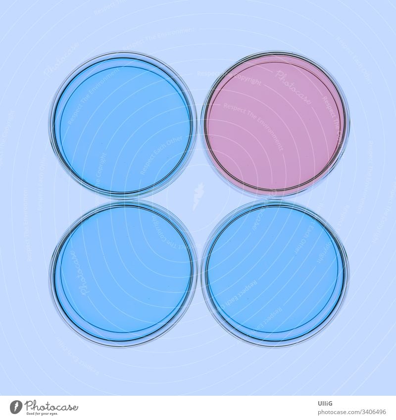 Four isolated petri dishes with blueish and pinkish jellylike matter in a re-enacted lab situation. bacteria bacterium breeding bacteriology virus virology