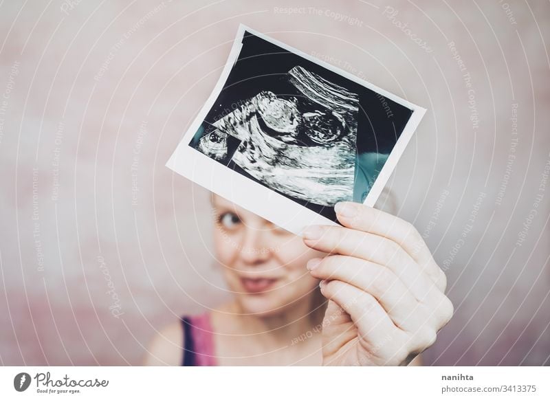 Woman holding the ultrasound of her baby pregnant pregnancy mom family second quarter trimester month 20 weeks health medical treatment equipment shot close