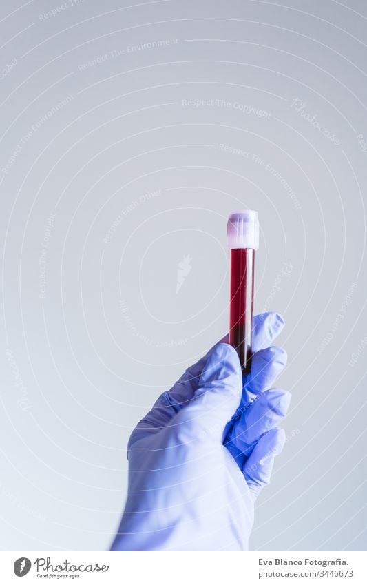 unrecognizable doctor hand holding blood test tube. coronavirus covid 2019 and medicina concept sample glasses experiment sterile fluid protection tool examine