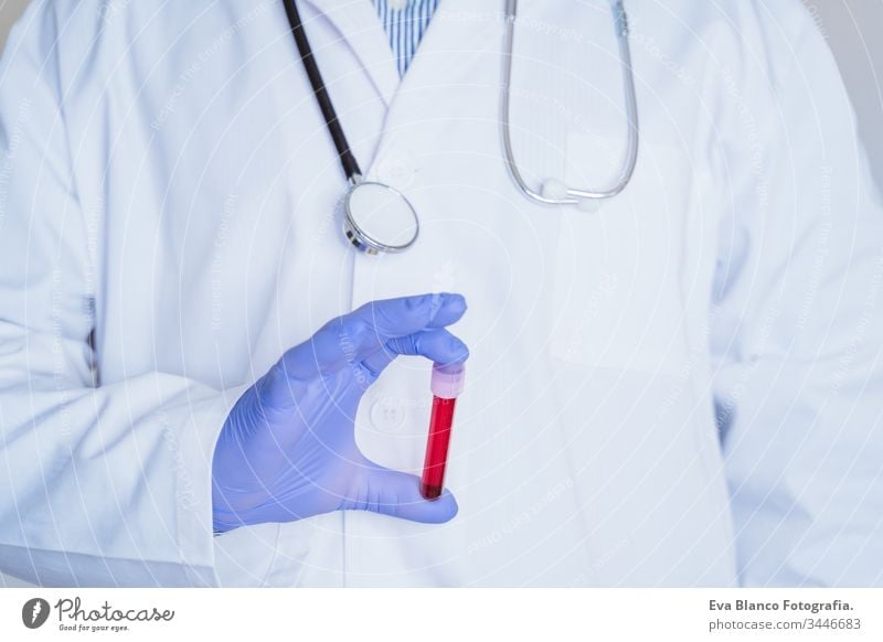 caucasian doctor man holding test tube with blood for 2019-nCoV analyzing. Chinese Coronavirus blood test concept. Covid-2019 coronavirus covid 2019