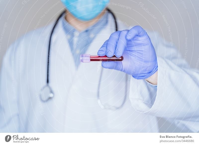 caucasian doctor man holding test tube with blood for 2019-nCoV analyzing. Chinese Coronavirus blood test concept. Covid-2019 coronavirus covid 2019