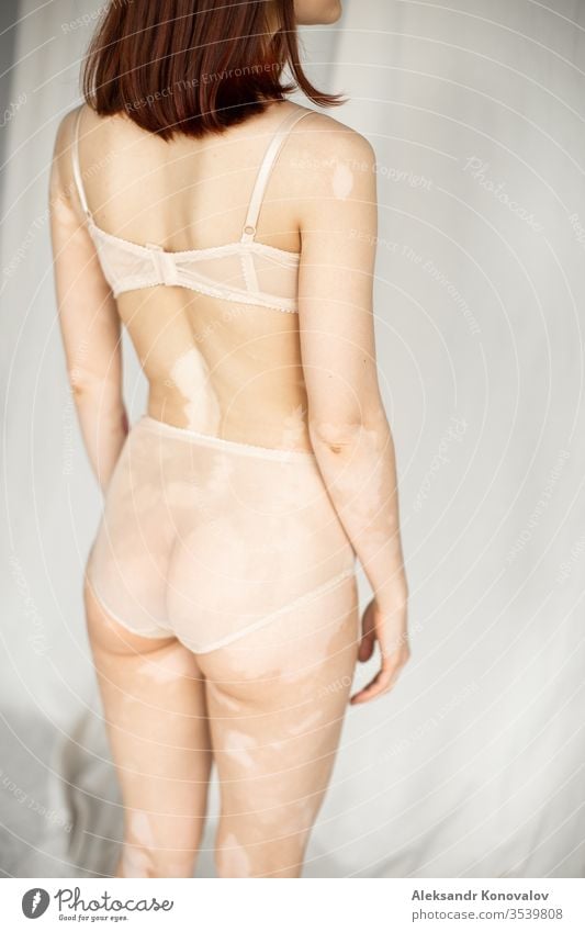 Young woman with pale skin and vitiligo stands on fabric backdrop in natural light in transparent underwear body beauty slim beautiful white naked isolated