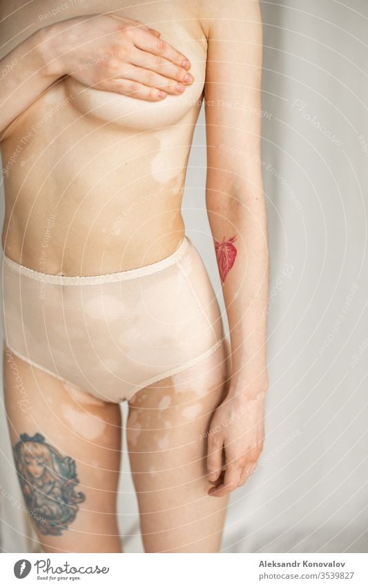 Young woman with pale skin and vitiligo stands on fabric backdrop in natural light in transparent underwear holding her breast body beauty slim beautiful white