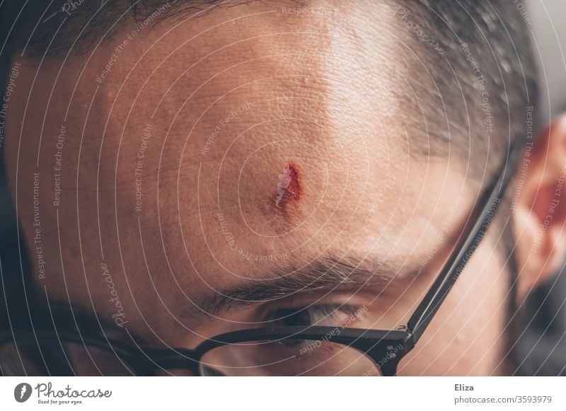 An injured man with a cut on his forehead Wound violation Man Forehead Head Bulge Pain Accident blossom Eyeglasses wounded painful Open Skin Hurt Close-up