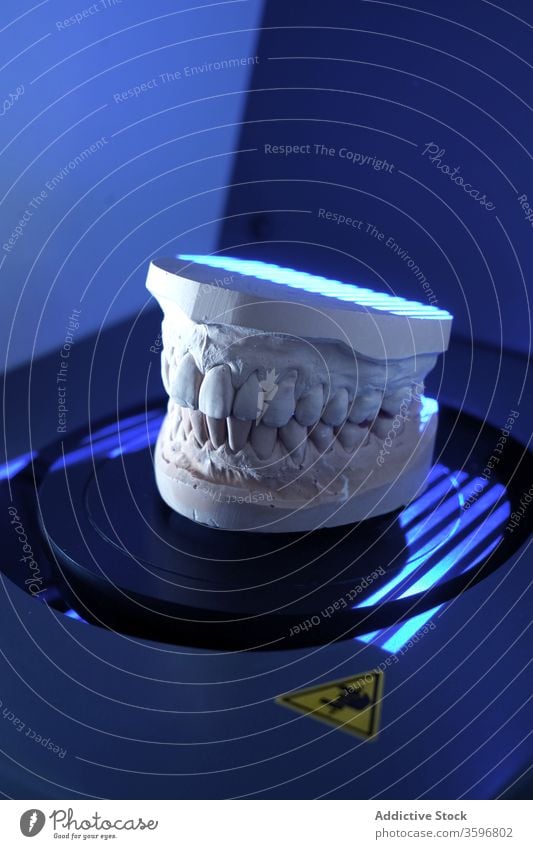Teeth cast in modern clinic dentist prosthesis denture work dental medical stomatology dentistry equipment instrument tool medicine orthodontic hand device