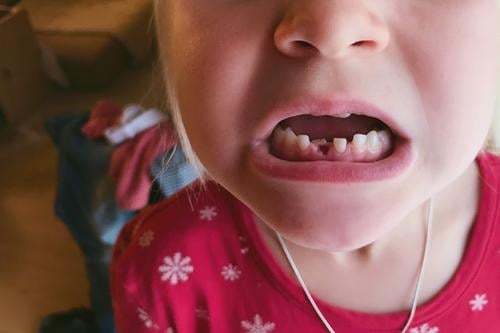 lieblingsmensch | mit biss! Kind Zähne Milchzähne Mund Gebiss beißen Detail Nahaufnahme
