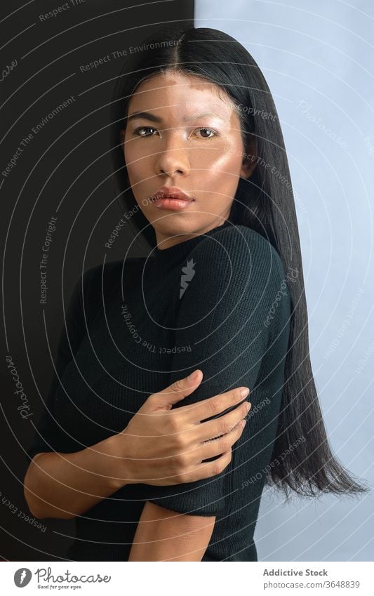 Ethnic model with vitiligo standing near wall at home skin condition emotionless disease sensual beauty seductive woman harmony feminine calm sick unemotional