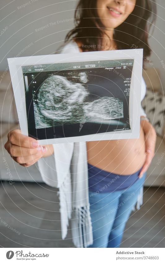Anonymous pregnant woman showing an ultrasound scan embrace stomach tenderness motherhood parenthood birth bonding examination newborn planning touch fertility