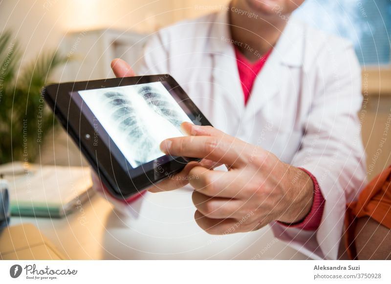 Smiling male doctor holding digital tablet, showing test results to patient in hospital. X-ray images on screen. Sick senior woman having a doctor appointment. Medical consultation.