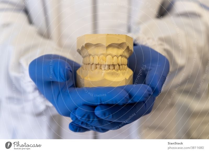 Dentist hands holding teeth model, denture dental tooth jaw dentist mouth white uniform. oral health hygiene medical dentistry care braces blue gloves