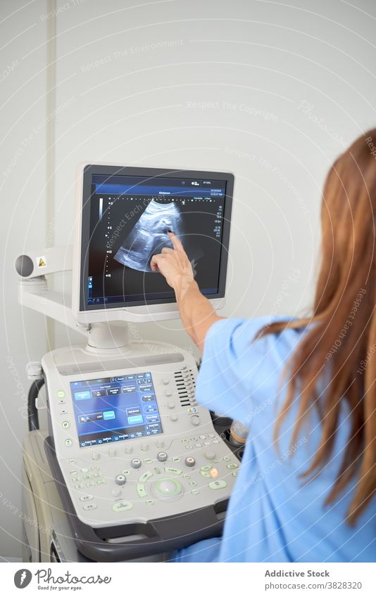 Anonymous ultrasound technician pointing at scanner monitor in clinic show sonography diagnostic video equipment women doctor machine uniform diagnose