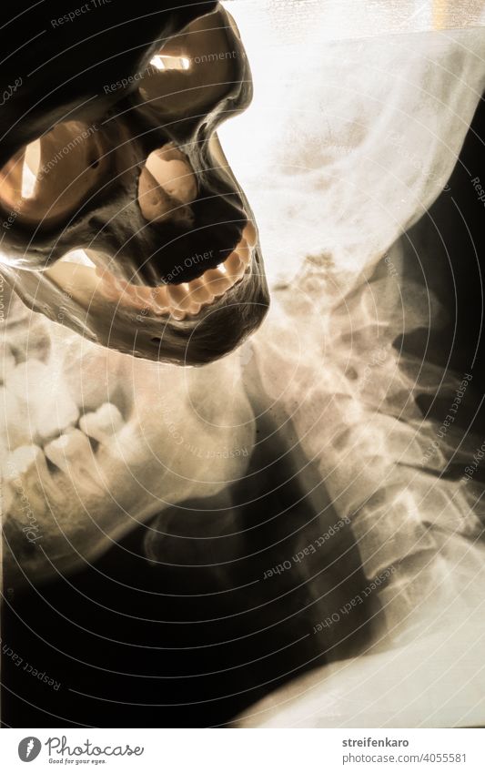 Encounter - X-ray image of skull and cervical spine meets a human skull Bone Human being Death's head Skeleton Spinal column medicine mortality Head Body