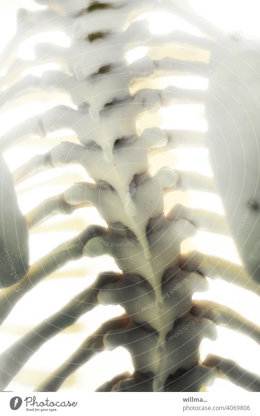 much ado about nothing. vertebra Spinal column Ribs Skeleton Anatomy Back Scoliosis Kyphosis Warp Backbone bend rib