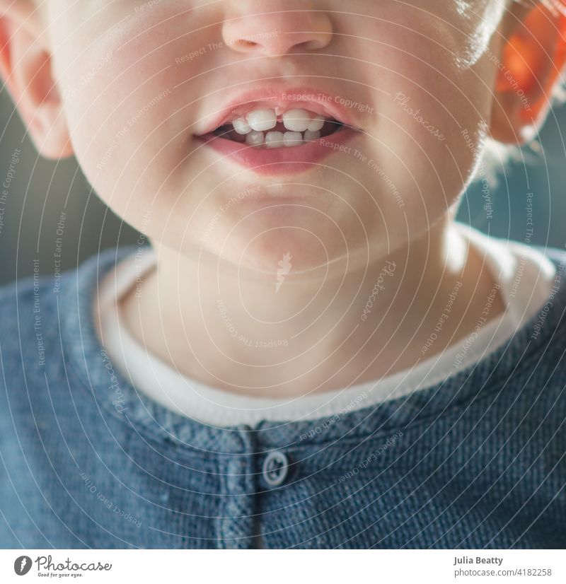 Toddler with teeth coming in; four teeth on top and bottom teething dental smile top teeth toddler child white clean lips chew bite independent milestone