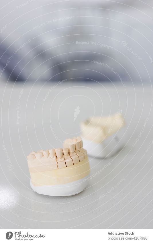Plaster jaw casts on table in clinic teeth orthodontic medical fake plaster professional upper dental oral gypsum material laboratory white beige color minimal