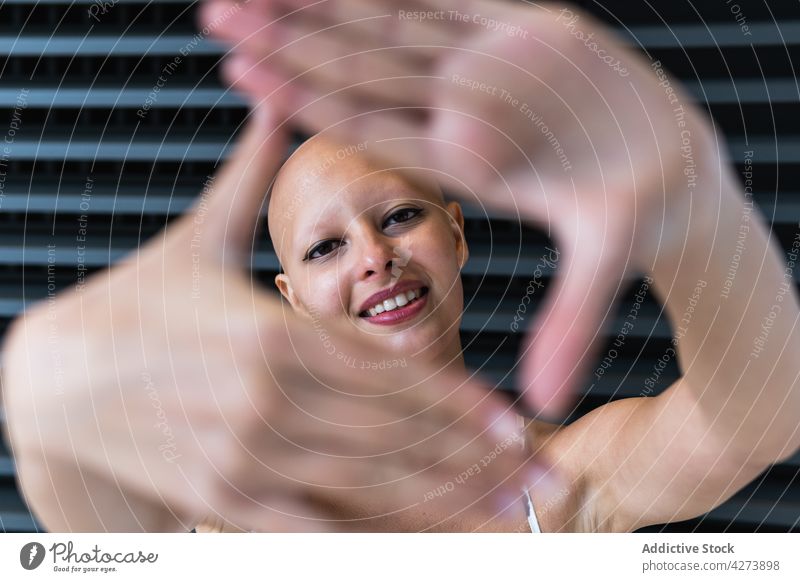 Positive young bald woman showing camera and smiling gesture smile positive alopecia trendy individuality delight style glad street female outfit hairless joy