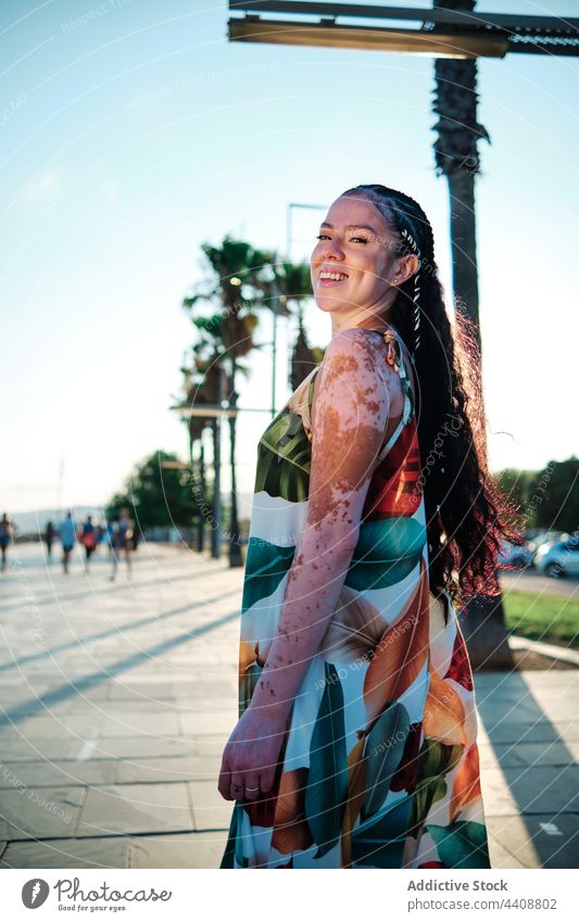 Happy woman with vitiligo standing on promenade in summer cheerful sunny positive embankment enjoy female smile delight content weekend happy city sunlight