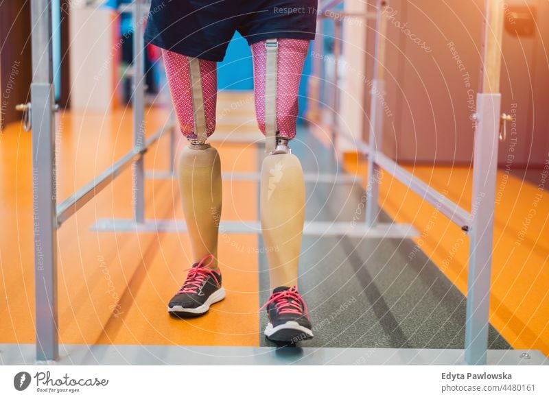 Close up of a woman with prosthetic legs using parallel bars physiotherapy determination recovery rehabilitation strength workout exercise fitness training