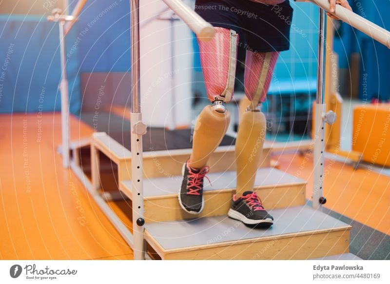 Close-up of an young woman with legs prosthesis at physiotherapy center determination recovery rehabilitation strength workout exercise fitness training sport