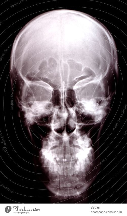 Roentgen head 1 Black White Skeleton Photographic technology Head Death's head Radiology