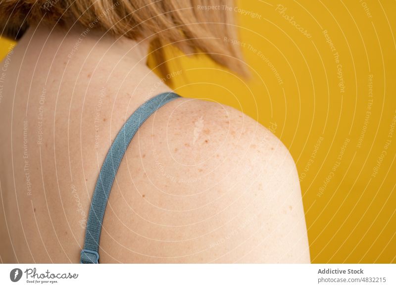 Crop faceless lady with freckles on shoulder in yellow studio woman bare shoulders feminine body positive model pigment individuality grace self esteem accept