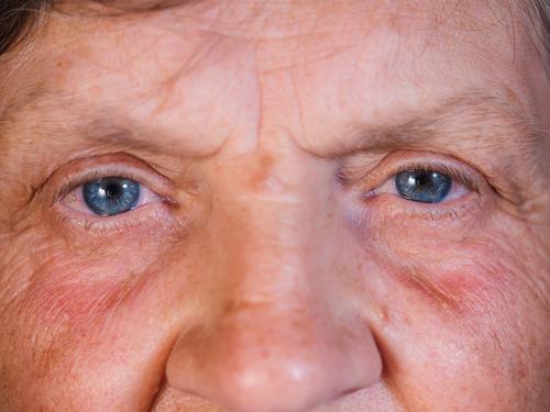 Contraction of the pupil. Beautiful blue eyes iris of middle-aged woman. Peepers of old grandmother with wrinkles. beautiful closeup cornea eyeball eyebrow