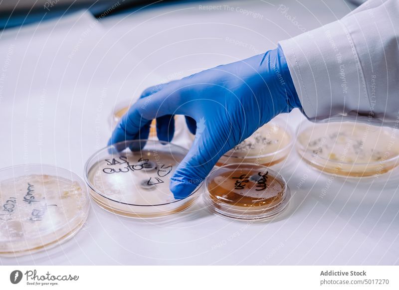 Woman Working With Petri Dishes In The Lab petri dishes agar technology infection colony technician scientist glove sample germs fungi media protective