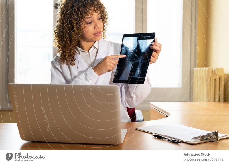 Crop ethnic doctor showing radiographic image against laptop in office medic x ray spine diagnostic analyze professional woman point radiography diagnosis