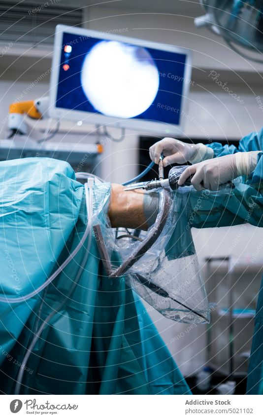 Crop surgeon conducting surgery through knee hands insert patient endoscope operating theater equipment medicine doctor man hospital room healthcare