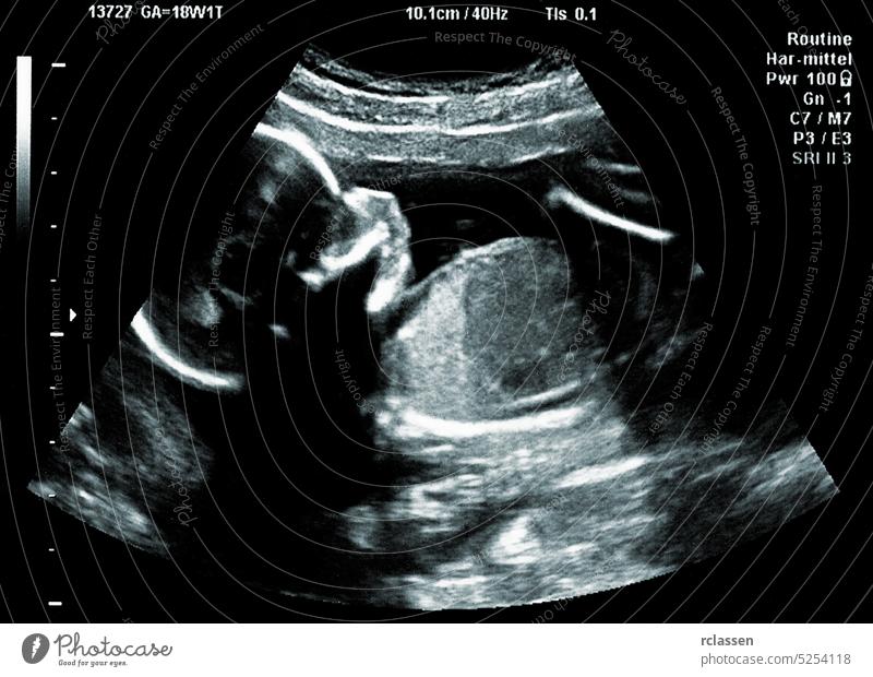 Ultrasound of baby in a mothers womb ultrasound scan sonogram fetus pregnancy pregnant sonar ultrasonography unborn woman 3d belly isolated medical prenatal