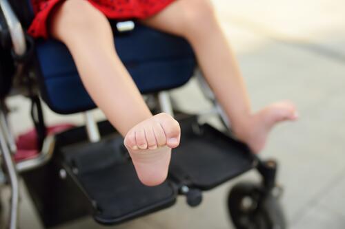 Disabled girl sitting in wheelchair. Close up photo of her legs spasticity muscles . Child cerebral palsy. Disability. Inclusion. disabled child adopted