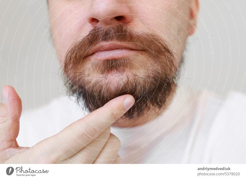 Cropped photo of bearded man shows first gray hairs on overgrown shaggy beard and moustahe. Loss of melanin at young age, causes-genetic predisposition, hormonal, disorders of the endocrine system