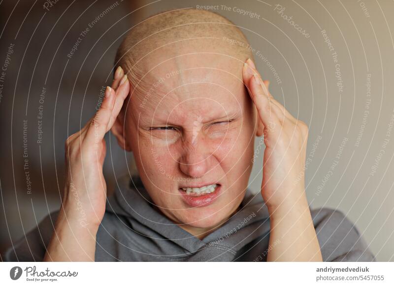 Bald annoyed woman touching head with fingers, suffering from headache after chemotherapy. Unhappy angry hairless cancer sick female is screaming, migraine. Oncology concept