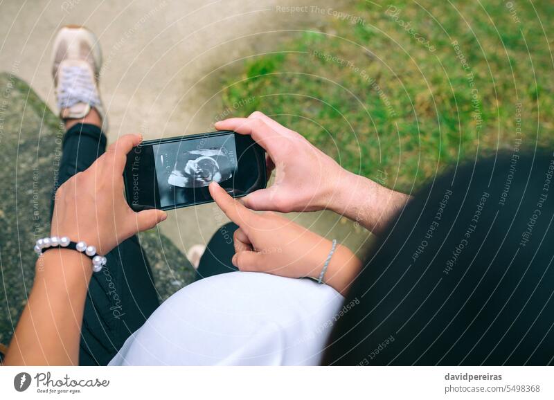Pregnant looking ultrasound scan on phone with her couple unrecognizable pregnant woman female partner ultrasonic echography photo mobile cell smartphone