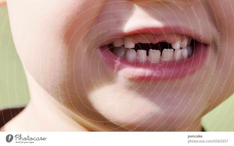 hilfreich | neue zähne Kind Mund Zahnlücke Wachstum Zähne Detail Leben Nahaufnahme beißen kauen Entwicklung