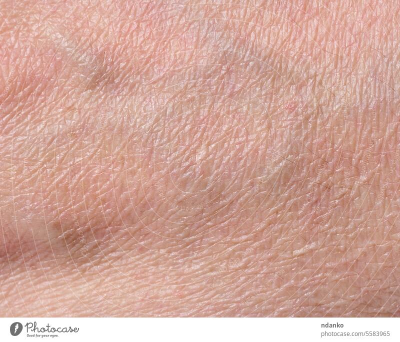 White person skin texture hand white people dry wrinkled macro caucasian human body dermatology